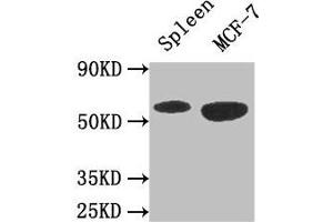Western Blot Positive WB detected in: Mouse spleen tissue, MCF-7 whole cell lysate All lanes: AMPK1 antibody at 3 μg/mL Secondary Goat polyclonal to rabbit IgG at 1/50000 dilution Predicted band size: 65, 66 kDa Observed band size: 65 kDa (PRKAA1 Antikörper  (Catalytic Subunit alpha))
