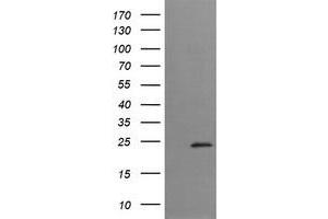 Image no. 1 for anti-Trafficking Protein Particle Complex 4 (TRAPPC4) antibody (ABIN1501264) (TRAPPC4 Antikörper)