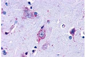 Anti-EDG7 antibody  ABIN1048537 IHC staining of human brain, amygdala. (LPAR3 Antikörper  (Cytoplasmic Domain))