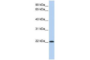 WB Suggested Anti-RNASE11 Antibody Titration: 0. (RNASE11 Antikörper  (Middle Region))