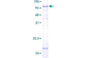 FARSB Protein (AA 1-589) (GST tag)