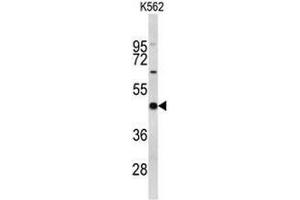 Western Blotting (WB) image for anti-Eukaryotic Translation Initiation Factor 4A2 (EIF4A2) (AA 339-369), (C-Term) antibody (ABIN952052)