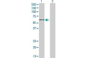 Western Blotting (WB) image for anti-Cytochrome P450, Family 19, Subfamily A, Polypeptide 1 (CYP19A1) (AA 1-503) antibody (ABIN514850)