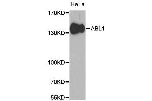 Western blot analysis of extracts of HeLa cells, using ABL1 antibody. (ABL1 Antikörper)