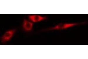 ABIN6274981 staining Hela cells by IF/ICC.