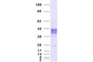 RAD9A Protein (Myc-DYKDDDDK Tag)