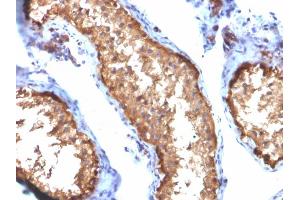 Formalin-fixed, paraffin-embedded human Testis stained with VCL Mouse Monoclonal Antibody (VCL/2572). (Vinculin Antikörper  (AA 174-322))
