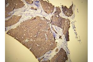 Immunohistochemistry (IHC) image for anti-Keratin 19 (KRT19) (AA 386-399), (C-Term) antibody (ABIN870577) (Cytokeratin 19 Antikörper  (C-Term))