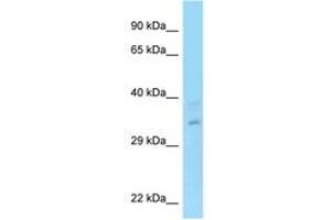 Image no. 1 for anti-Regulation of Nuclear Pre-mRNA Domain Containing 1A (RPRD1A) (AA 79-128) antibody (ABIN6748172) (RPRD1A Antikörper  (AA 79-128))