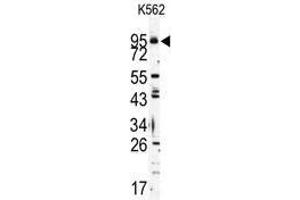 Image no. 2 for anti-Toll-Like Receptor 6 (TLR6) (C-Term) antibody (ABIN357055) (TLR6 Antikörper  (C-Term))