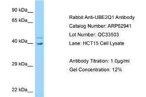 Western Blotting (WB) image for anti-Ubiquitin-Conjugating Enzyme E2Q Family Member 1 (UBE2Q1) (Middle Region) antibody (ABIN2789307) (UBE2Q1 Antikörper  (Middle Region))