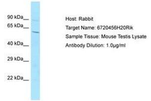 Image no. 1 for anti-Chromosome 14 Open Reading Frame 101 (C14orf101) (AA 201-250) antibody (ABIN6749829) (C14orf101 Antikörper  (AA 201-250))