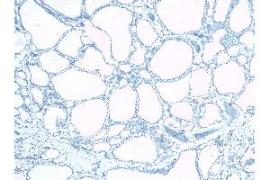 Immunohistochemistry (IHC) image for anti-Ectonucleotide Pyrophosphatase/phosphodiesterase 1 (ENPP1) (C-Term) antibody (ABIN185487)