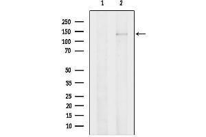 anti-phospholipase C beta 2 (PLCb2) (Internal Region) antibody