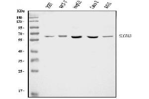 Western blot analysis of Dopamine Transporter/SLC6A3 using anti-Dopamine Transporter/SLC6A3 antibody (ABIN7599500).