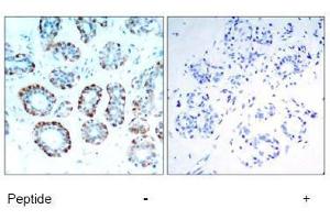 Image no. 1 for anti-BCL2-Like 11 (Apoptosis Facilitator) (BCL2L11) (Ser65) antibody (ABIN197552) (BIM Antikörper  (Ser65))