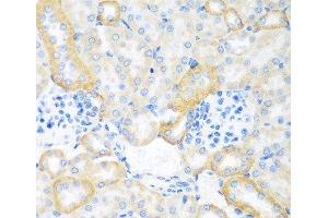 Immunohistochemistry of paraffin-embedded Mouse kidney using CEACAM7 Polyclonal Antibody at dilution of 1:100 (40x lens). (CEACAM7 Antikörper)