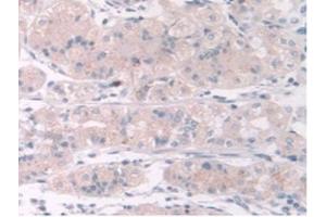 IHC-P analysis of Human Stomach Tissue, with DAB staining. (TPMT Antikörper  (AA 26-227))
