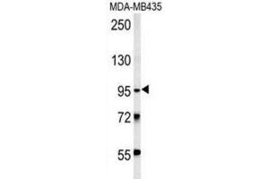 Western Blotting (WB) image for anti-Thyrotropin Releasing Hormone Degrading Enzyme (TRHDE) antibody (ABIN3002402) (TRHDE Antikörper)