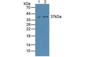 Figure. (Caspase 4 Antikörper  (AA 290-377))