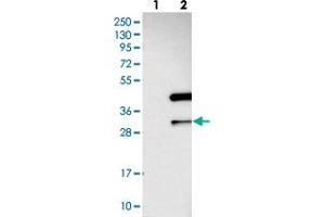 Western blot analysis of Lane 1: Negative control (vector only transfected HEK293T lysate), Lane 2: Over-expression Lysate (Co-expressed with a C-terminal myc-DDK tag (~3. (ANKRD23 Antikörper)