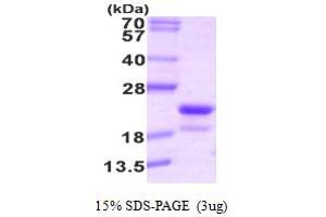 SDS-PAGE (SDS) image for Riboflavin Kinase (RFK) (AA 1-162) protein (His tag) (ABIN667744)