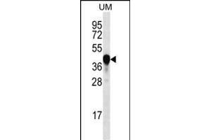PROX2 Antibody (C-term) (ABIN656460 and ABIN2845744) western blot analysis in uterus tumor cell line lysates (35 μg/lane).