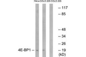 Western Blotting (WB) image for anti-Eukaryotic Translation Initiation Factor 4E Binding Protein 1 (EIF4EBP1) (AA 13-62) antibody (ABIN2888940) (eIF4EBP1 Antikörper  (AA 13-62))