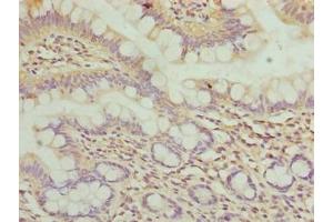 Immunohistochemistry of paraffin-embedded human small intestine tissue using ABIN7175786 at dilution of 1:100 (WDR66 Antikörper  (AA 1-1154))