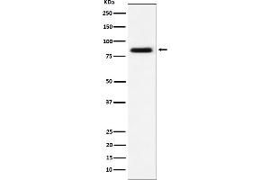 Western blot analysis of CD105 expression in HUVEC cell lysate. (Rekombinanter Endoglin Antikörper)