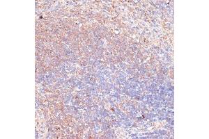 Immunohistochemistry (IHC) image for anti-Thioredoxin-Related Transmembrane Protein 1 (TMX1) (AA 210-280) antibody (ABIN7270808)