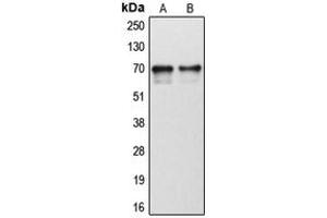 Western blot analysis of Cytochrome P450 1B1 expression in human tonsil (A), human liver (B) whole cell lysates. (CYP1B1 Antikörper  (Center))