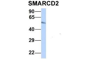 Host:  Rabbit  Target Name:  SMARCD2  Sample Type:  Human Fetal Heart  Antibody Dilution:  1. (SMARCD2 Antikörper  (Middle Region))
