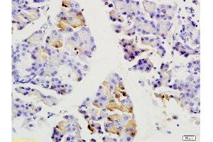 Formalin-fixed and paraffin embedded rat pancreas labeled with Anti-SGCB/SGC Polyclonal Antibody, Unconjugated  at 1:200 followed by conjugation to the secondary antibody and DAB staining.