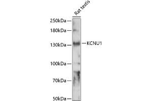 Western blot analysis of extracts of rat testis, using KCNU1 antibody (ABIN7269471) at 1:1000 dilution.