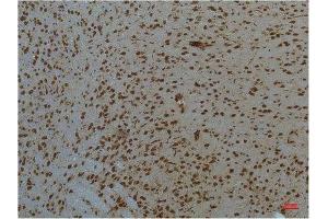 Immunohistochemistry (IHC) analysis of paraffin-embedded Mouse Brain Tissue using STAT3 Mouse Monoclonal Antibody diluted at 1:200. (STAT3 Antikörper)