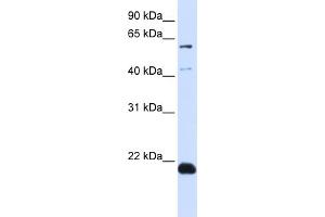WB Suggested Anti-C14orf180 Antibody Titration:  0. (C14orf180 Antikörper  (N-Term))