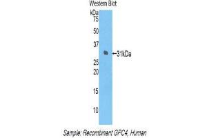 Western Blotting (WB) image for anti-Glypican 4 (GPC4) (AA 261-527) antibody (ABIN1859055) (GPC4 Antikörper  (AA 261-527))