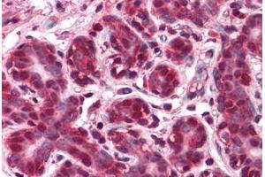 Immunohistochemistry (Formalin-fixed Paraffin-embedded Sections) (IHC (fp)) image for anti-Brain and Reproductive Organ-Expressed (TNFRSF1A Modulator) (BRE) (AA 9-338) antibody (ABIN604922)