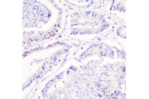 IHC analysis of FHL using anti-FHL antibody (ABIN7600488).