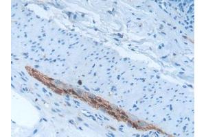 Used in DAB staining on fromalin fixed paraffin- embedded brain tissue