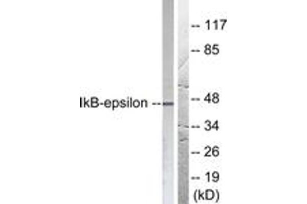 NFKBIE Antikörper  (AA 131-180)