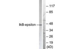 Western Blotting (WB) image for anti-Nuclear Factor of kappa Light Polypeptide Gene Enhancer in B-Cells Inhibitor, epsilon (NFKBIE) (AA 131-180) antibody (ABIN2888569) (NFKBIE Antikörper  (AA 131-180))