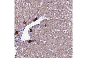 Immunohistochemical staining of human liver with RPS26 polyclonal antibody  shows strong cytoplasmic positivity in bile duct cells at 1:20-1:50 dilution. (RPS26 Antikörper)