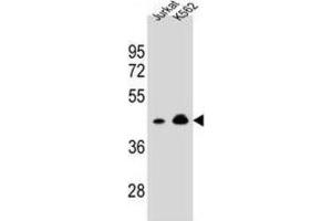 Western Blotting (WB) image for anti-Olfactory Receptor, Family 10, Subfamily A, Member 4 (OR10A4) antibody (ABIN2995885) (OR10A4 Antikörper)