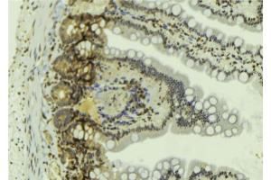 ABIN6269060 at 1/100 staining Mouse colon tissue by IHC-P. (JAK2 Antikörper  (C-Term))