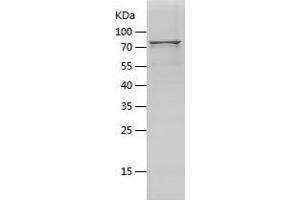 Western Blotting (WB) image for V-Akt Murine Thymoma Viral Oncogene Homolog 1 (AKT1) (AA 1-480) protein (His-IF2DI Tag) (ABIN7125674)
