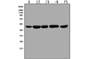 Western blot analysis of SLC9A3R1 using anti-SLC9A3R1 antibody (ABIN6719642).