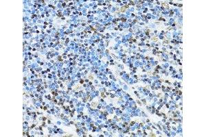 Immunohistochemistry of paraffin-embedded Human appendix using ITGB3BP Polyclonal Antibody at dilution of 1:100 (40x lens). (ITGB3BP Antikörper)