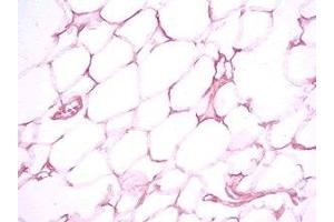 Immunohistochemistry (IHC) image for anti-serpin Peptidase Inhibitor, Clade A (Alpha-1 Antiproteinase, Antitrypsin), Member 12 (SERPINA12) (AA 63-104) antibody (ABIN2872791)